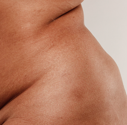 Menopause Nutrition Consultation